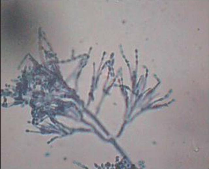 Microscopic morphology of Paecilomyces varioti showing chains of single celled phialoconidia produced in basipetal succession from a phialide. phialides are swollen at their bases, gradually tapering towards their apices and may form a brush - like penicillus