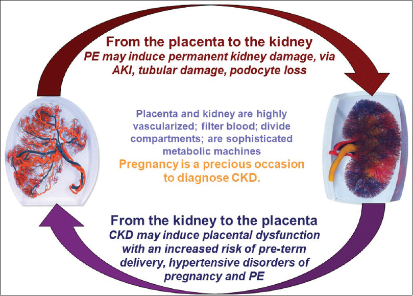 Pregnancy and kidney function: complex interactions between two organs, the kidney and placenta. PE: Preeclampsia, AKI: Acute kidney injury, CKD: Chronic kidney disease