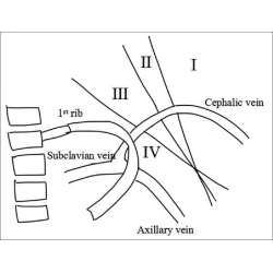 Article figure