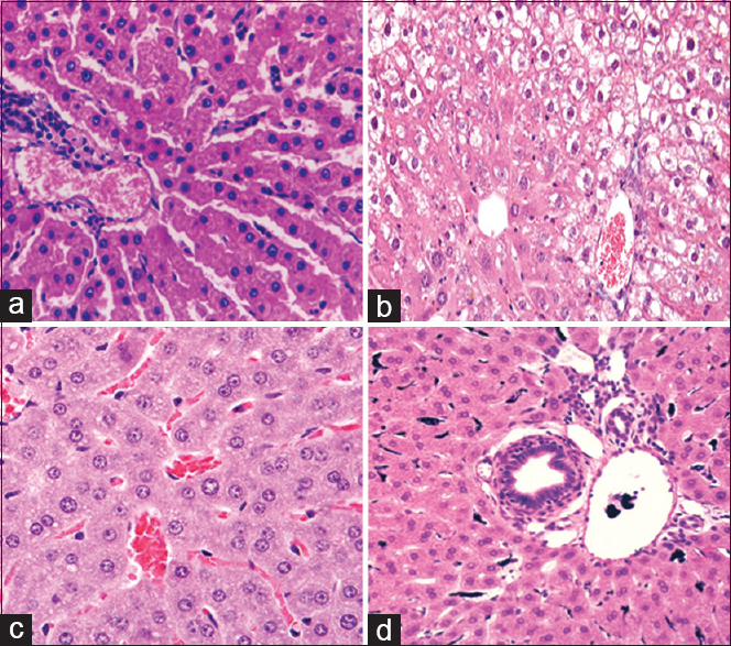 Effect of rosmarinic acid on liver histopathological changes in methotrexate induced hepatotoxicity model. (Stained by hematoxylin and eosin with magnified × 400). a: Sham, b: MTX, c: MTX-RA 100, d: MTX-RA 200