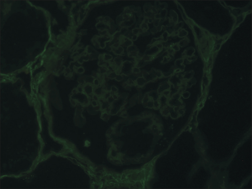 Immunofluorescence showing negative staining of IgG on second kidney biopsy