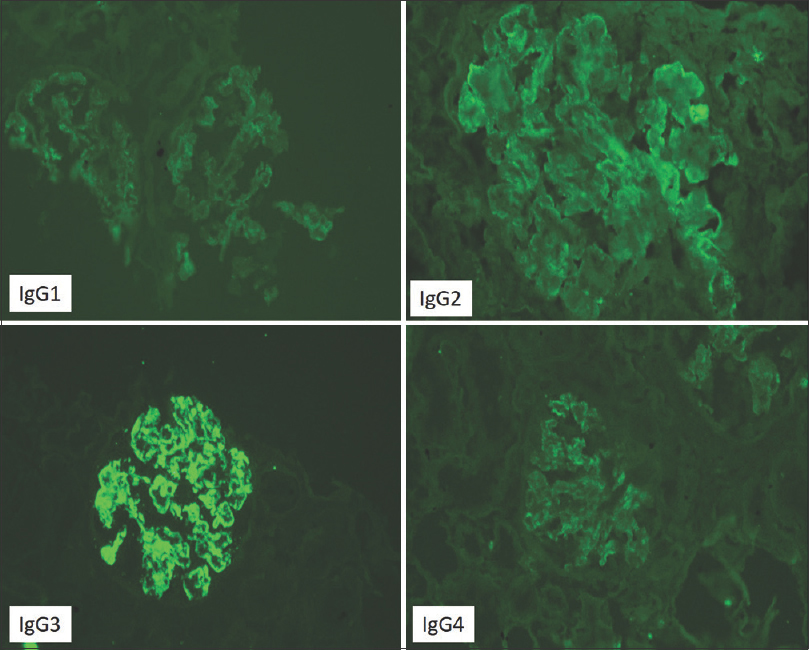 IgG isotype staining showing positivity for IgG3 and negative for IgG1, IgG2 and IgG4.I (FITC-labeled antibodies 200×)