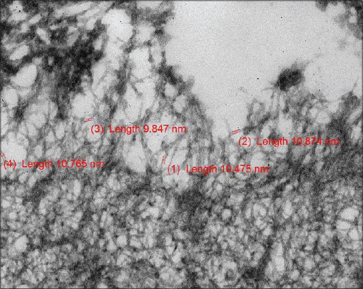 Amyloid fibrils measured between 9 and 11.6 nm