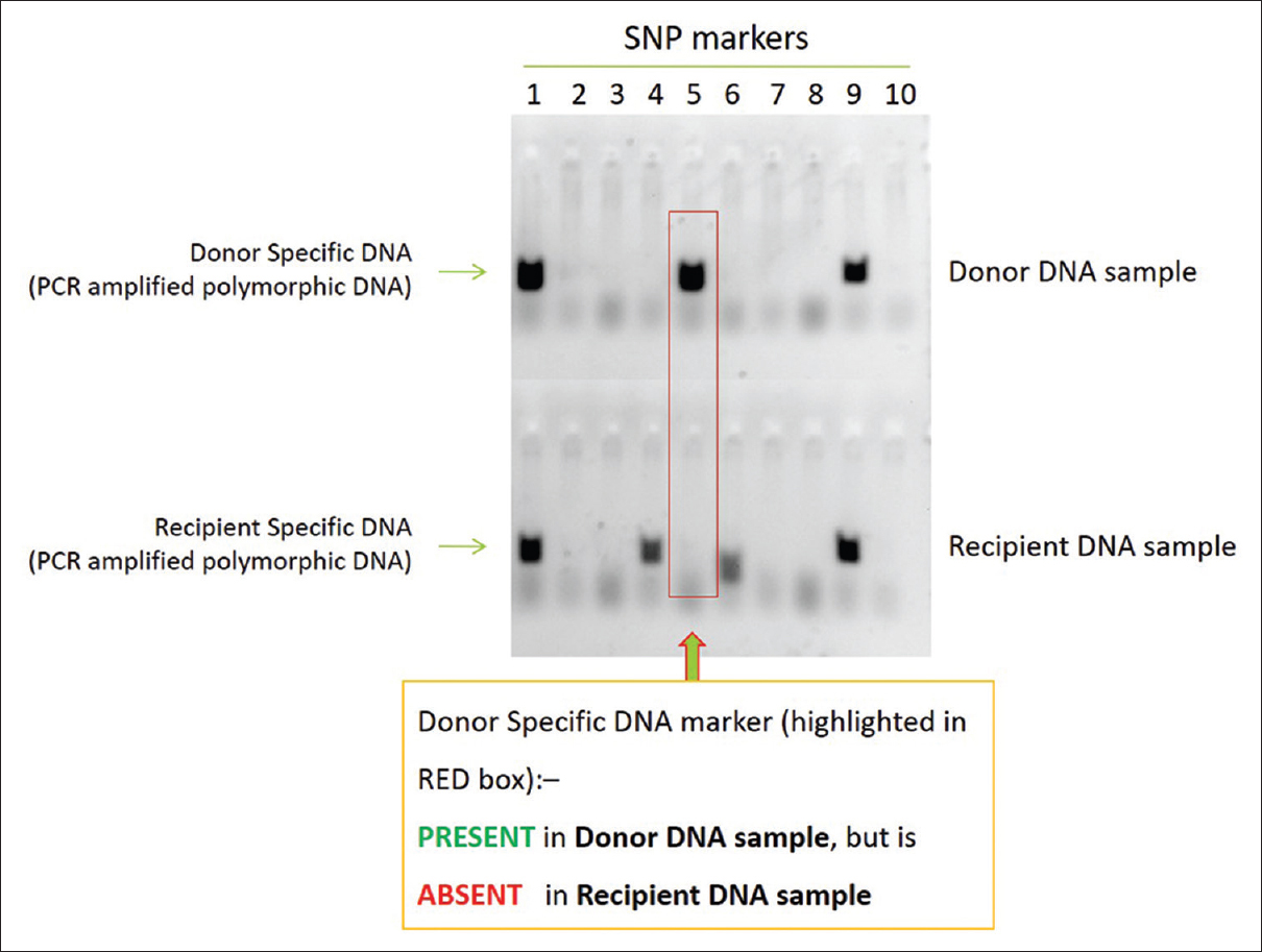 Identification of DNA markers – bench work