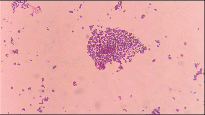 Gram stain of a colony showing Gram-positive cocci in clusters, compatible with Staphylococcus aureus