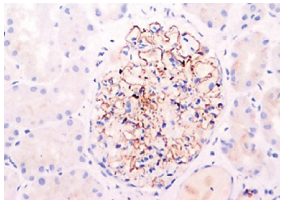 NELL-1 antigen demonstration by immunohistochemistry (Original magnification x200). NELL-1: Neural epidermal growth factor-like 1