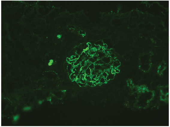 NELL-1 staining on immunofluorescence (Original magnification x200). NELL-1: Neural epidermal growth factor-like 1