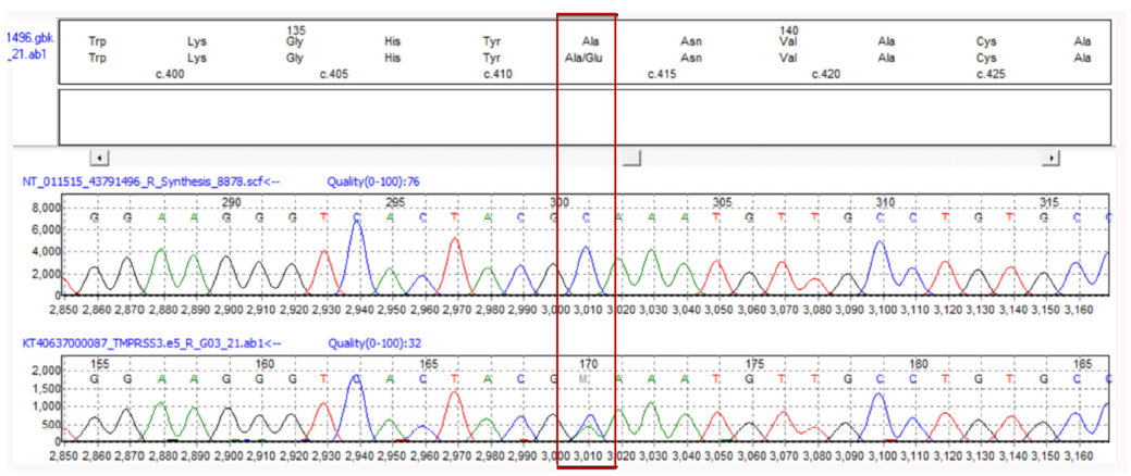 Sanger sequencing data (electropherogram) for the provided sample showing nucleotide change at chr21: c.413C>A,, (p.Ala138Glu) in TMPRSS3 gene. Red, green, black, and blue colored peaks show thymine, adenine, guanine, and cytosine bases, respectively. The red rectangle in the image highlights a specific nucleotide change in DNA sequencing data (electropherogram).