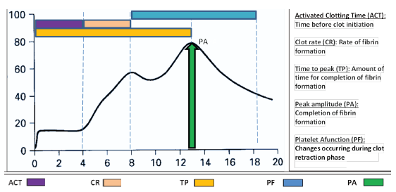 Graphical presentation of Sonodot signature curve and its interpretation.