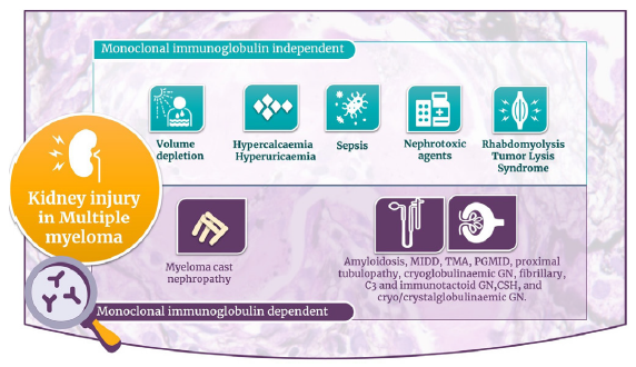 Causes of kidney injury in multiple myeloma. CSH: Crystal-storing histiocytosis, GN: Glomerulonephritis, MIDD: Monoclonal immunoglobulin deposition diseases, PGNMID: Proliferative glomerulonephritis with monoclonal IgG deposits, TMA: Thrombotic microangiopathy.