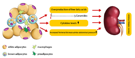 Possible pathways of Perirenal adipose tissue causing Chronic kidney disease.48