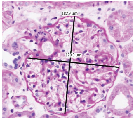 Measurement of glomerular diameters (H&E stain, 20×). H&E: hematoxylin and eosin.