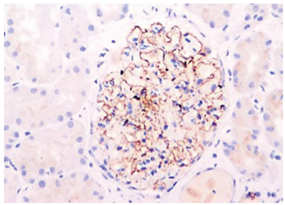 NELL-1 antigen demonstration by immunohistochemistry (Original magnification x200). NELL-1: Neural epidermal growth factor-like 1.