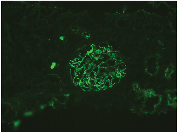 NELL-1 staining on immunofluorescence (Original magnification x200). NELL-1: Neural epidermal growth factor-like 1.