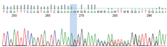 Sanger sequencing data (electropherogram) showing nucleotide change at c.704dupA (p.Asn235Lysfs*21) in the CD46 gene. Red, green, black, and blue color peaks show thymine, adenine, guanine, and cytosine bases, respectively.