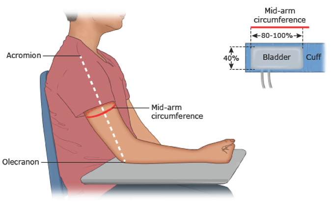 Pediatric blood pressure measurement - cuff sizing and position.9