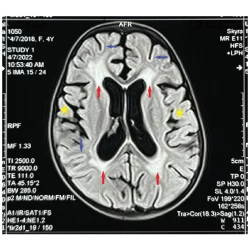 Article figure