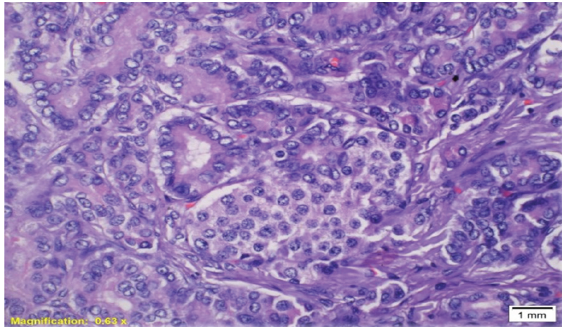 Close proximity of ducts and islet cell cluster forming ductulo–insular complex H&E stain with 40x. H&E: Hematoxylin and Eosin.