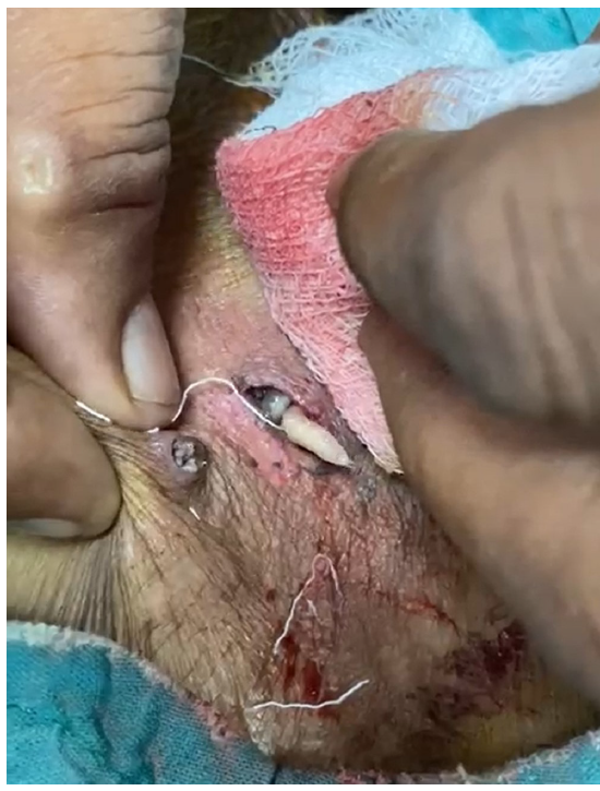 A large maggot emerging from the tunnel.
